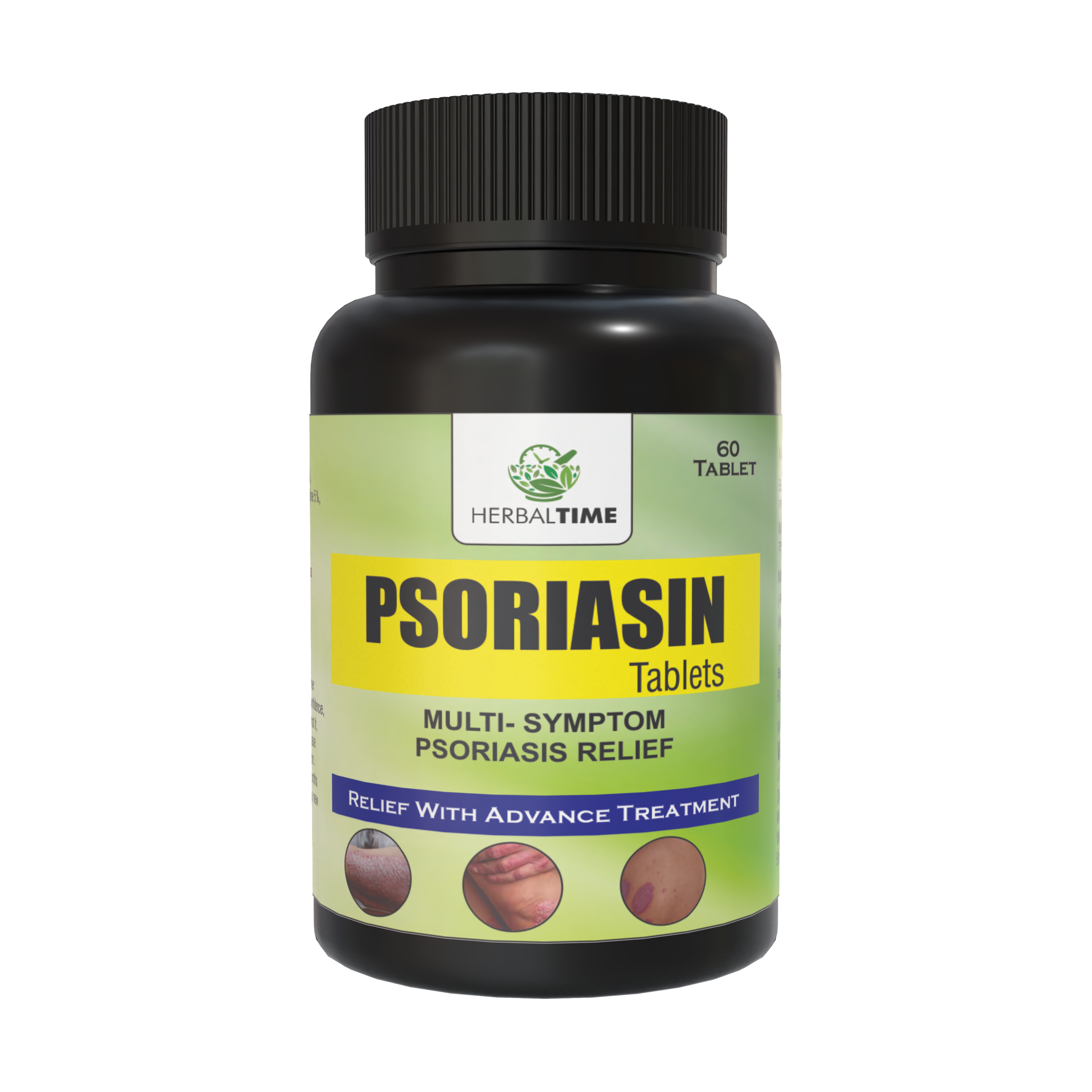 Psoriasin Tablet