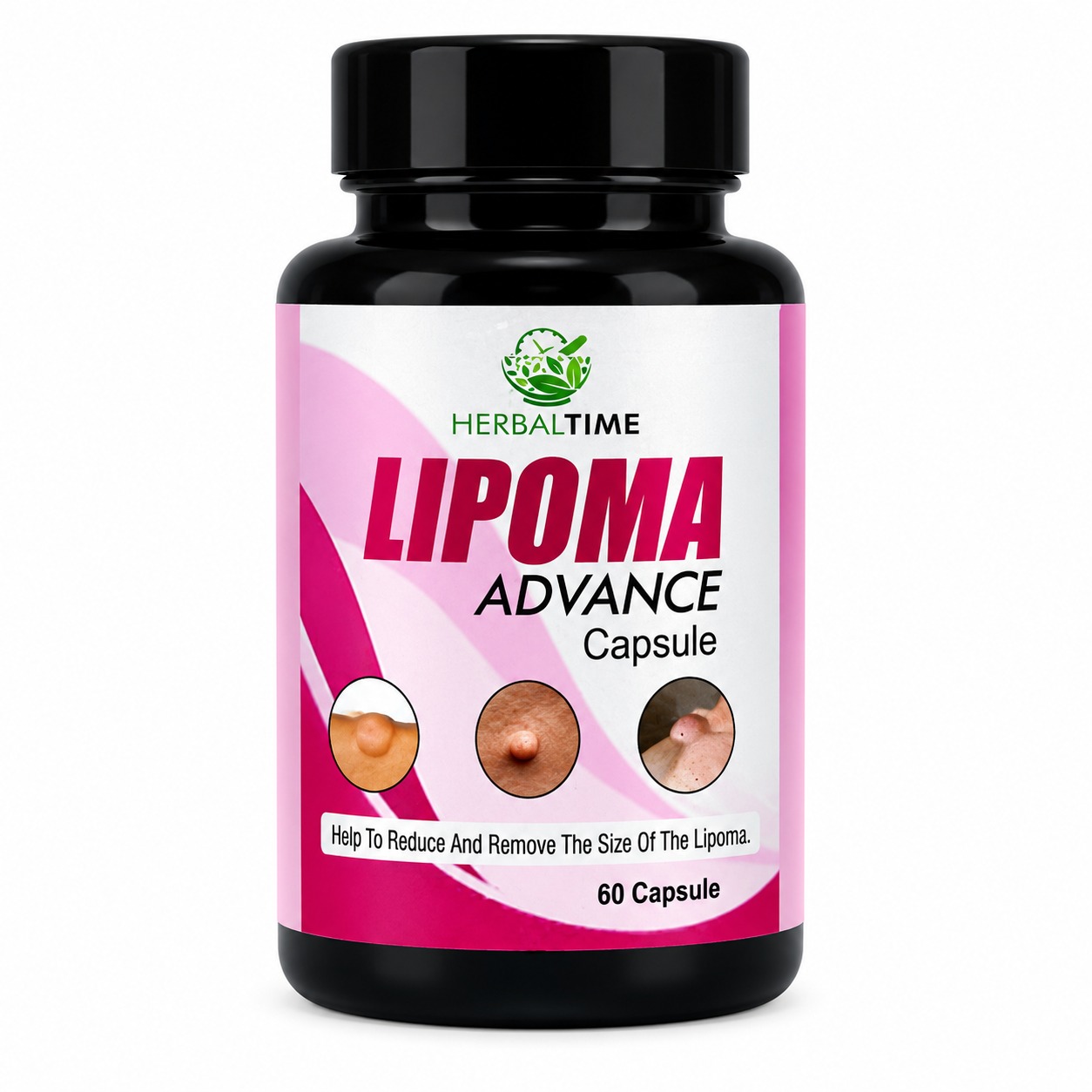 Lipoma Advance Capsule